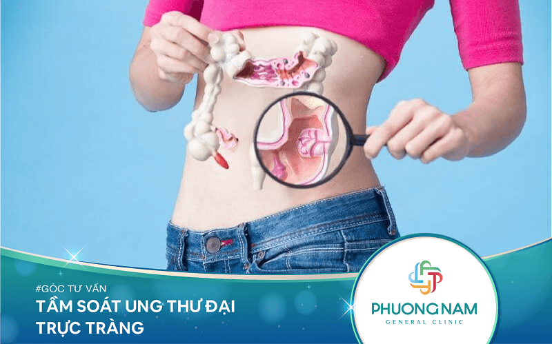 Tầm Soát Ung Thư Đại Trực Tràng – Phát Hiện Sớm Hơn Để Muộn!