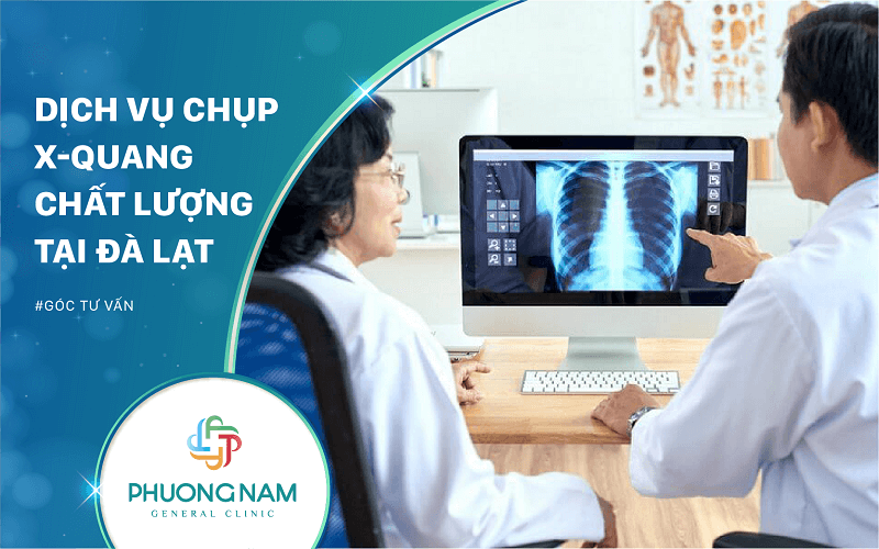 Top 5 Cơ sở Chụp X-Quang Đà Lạt chính xác, an toàn