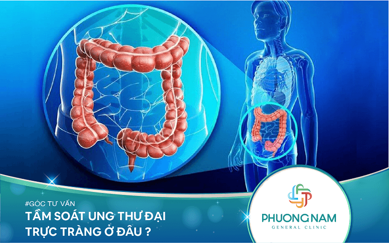 Tầm soát ung thư đại trực tràng ở đâu?
