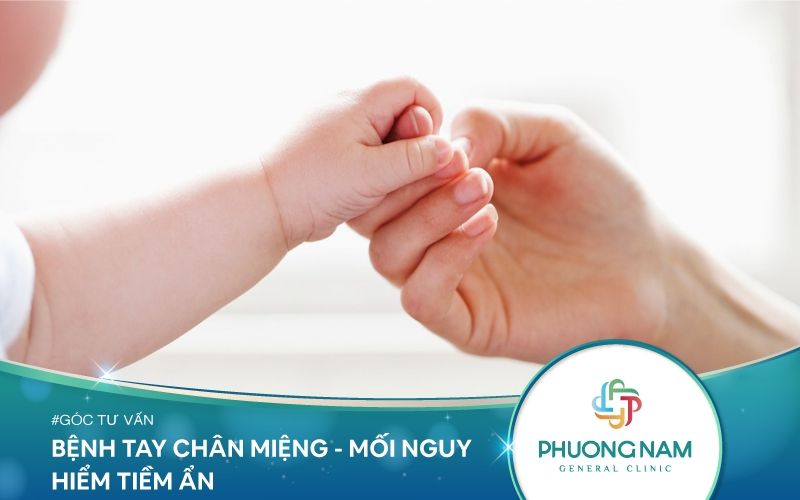 Bệnh Tay Chân Miệng Ở Trẻ Em – Mối Nguy Hiểm Tiềm Ẩn