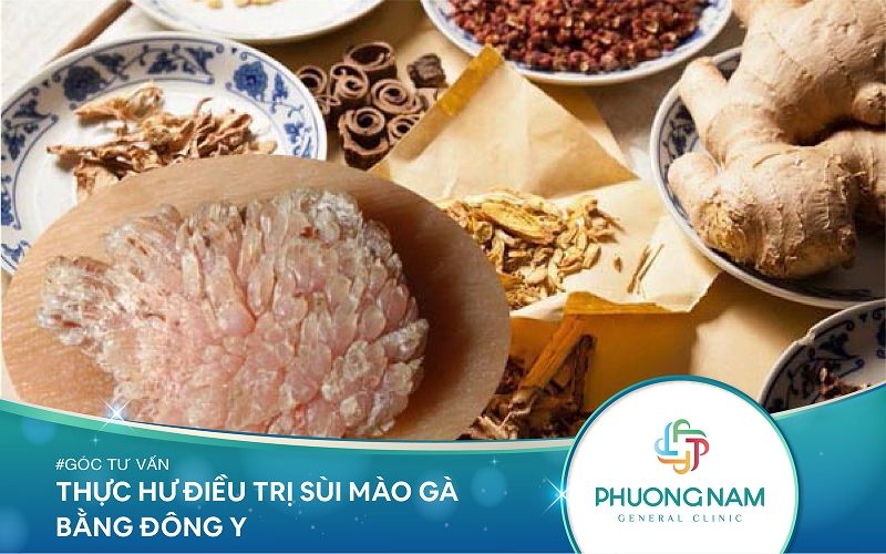 Thực Hư Điều Trị Sùi Mào Gà Bằng Đông Y