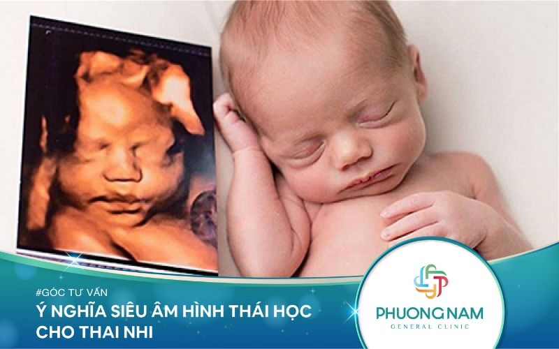 Ý Nghĩa Siêu Âm Hình Thái Học Cho Thai Nhi Mà Mẹ Bầu Quan Tâm