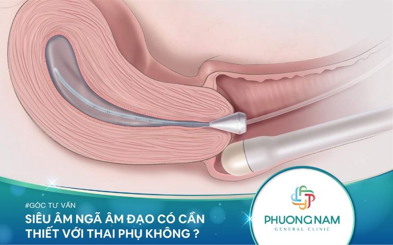Siêu Âm Ngã Âm Đạo Có Cần Thiết Với Thai Phụ Không?