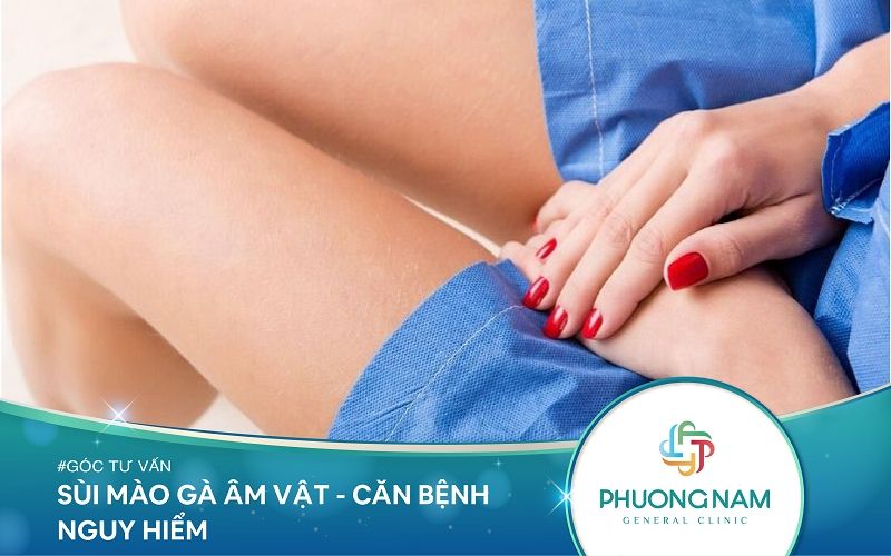 Sùi Mào Gà Âm Vật Ở Nữ Giới