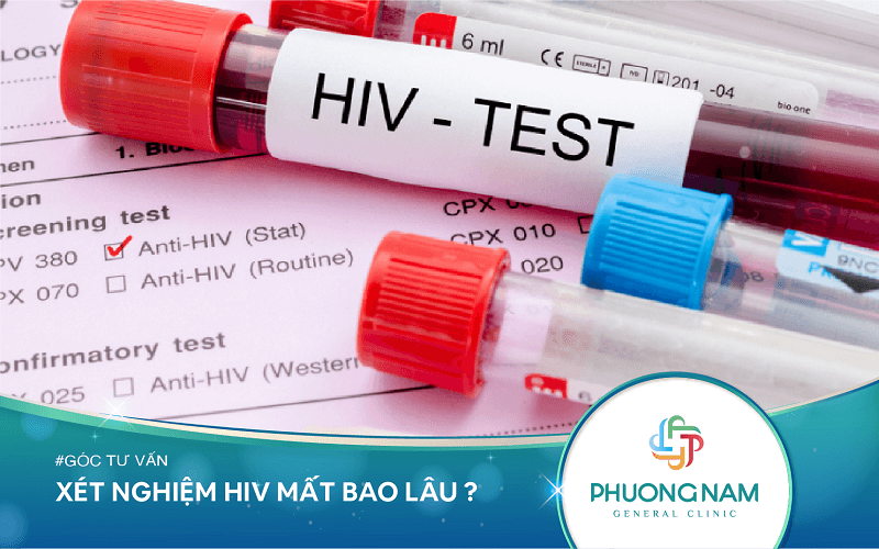 Xét nghiệm HIV mất bao lâu? Chuẩn bị gì trước khi làm xét nghiệm?
