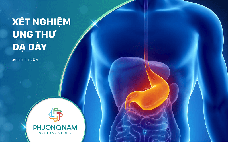 Xét Nghiệm Ung Thư Dạ Dày | Bài Viết Dành Cho Những Người Trên 30