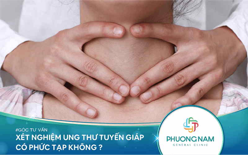 Xét Nghiệm Ung Thư Tuyến Giáp Có Phức Tạp Không?