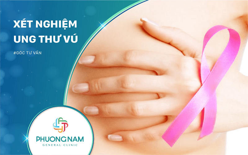 Xét Nghiệm Ung Thư Vú – Kết Quả Chính Xác – Địa Chỉ Uy Tín