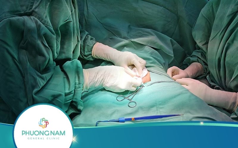 Cắt Bao Quy Đầu Tại Đà Lạt, Lâm Đồng Ở Đâu Uy Tín?