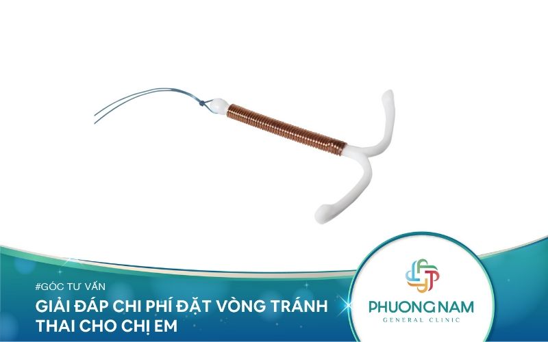 Giải Đáp Chi Phí Đặt Vòng Cho Chị Em Phụ Nữ