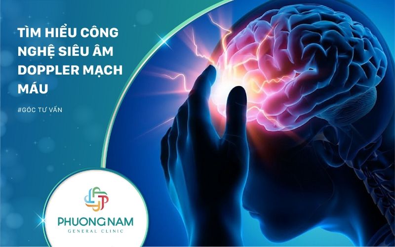 Tìm Hiểu Siêu Âm Doppler Mạch Máu Trong Công Nghệ Chẩn Đoán