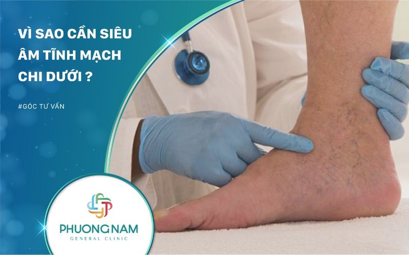 Vì Sao Cần Siêu Âm Tĩnh Mạch Chi Dưới? – Đa Khoa Phương Nam Đà Lạt