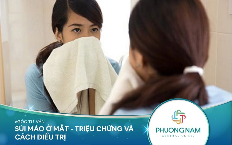 Sùi Mào Ở Mắt – Triệu Chứng Và Cách Điều Trị