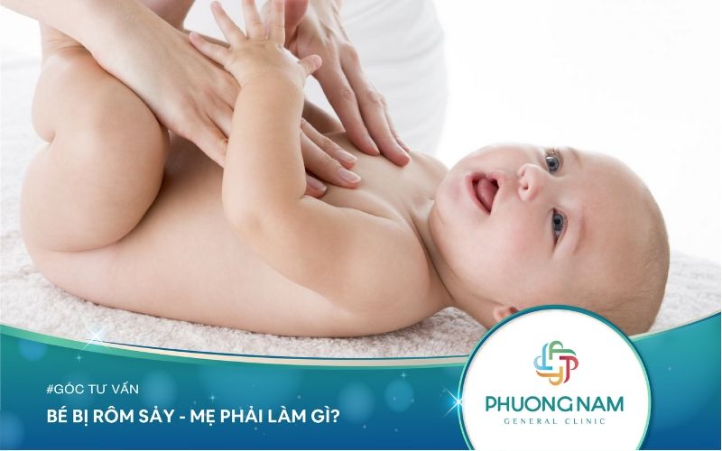 Bé Bị Rôm Sảy – Mẹ Phải Làm Gì?