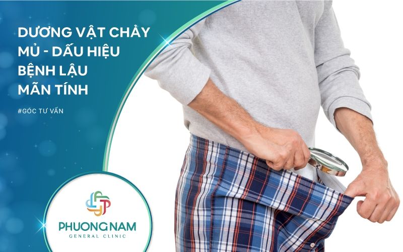Dương Vật Chảy Mủ – Triệu Chứng Của Bệnh Lậu Mãn Tính Ở Nam Giới