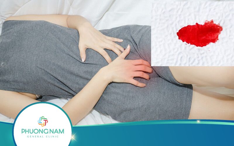 Ra Máu Bất Thường Ở Vùng Kín – Cảnh Báo Nhiều Bệnh Phụ Khoa Nguy Hiểm