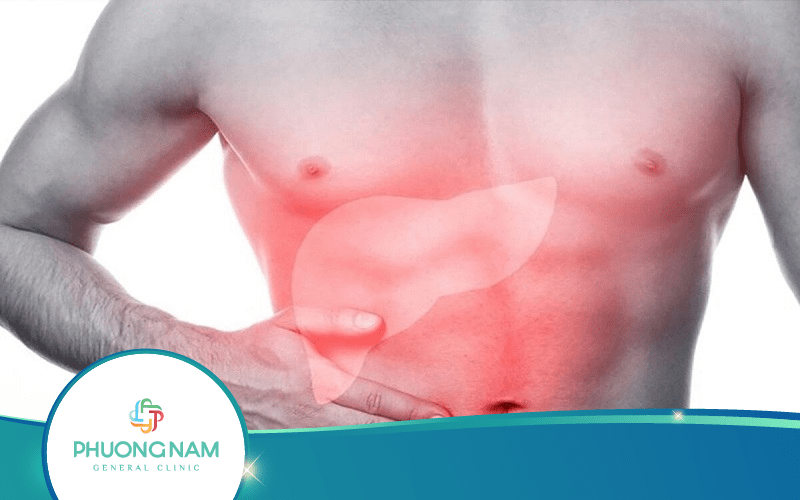 10 Lý Do Để Bác Sĩ Chỉ Định Siêu Âm Ung Thư Gan