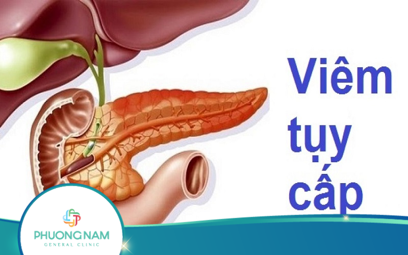 Quy Trình Siêu Âm Viêm Tụy Cấp Như Thế Nào?