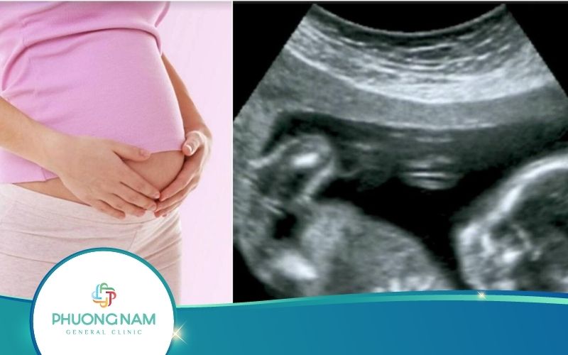 Siêu Âm Thai 12 Tuần Tuổi Cho Mẹ Bầu Biết Được Điều Gì?
