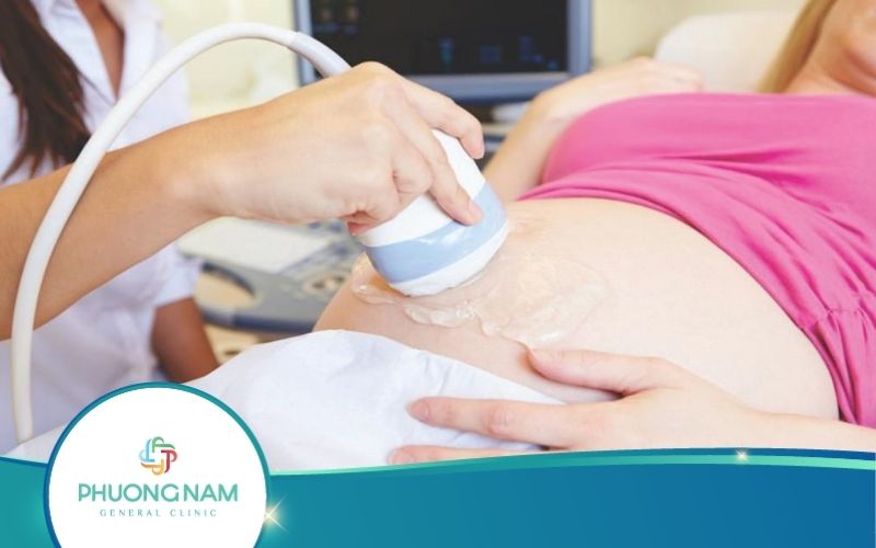 Siêu Âm Thai 14 Tuần Tuổi Có Chính Xác Không?