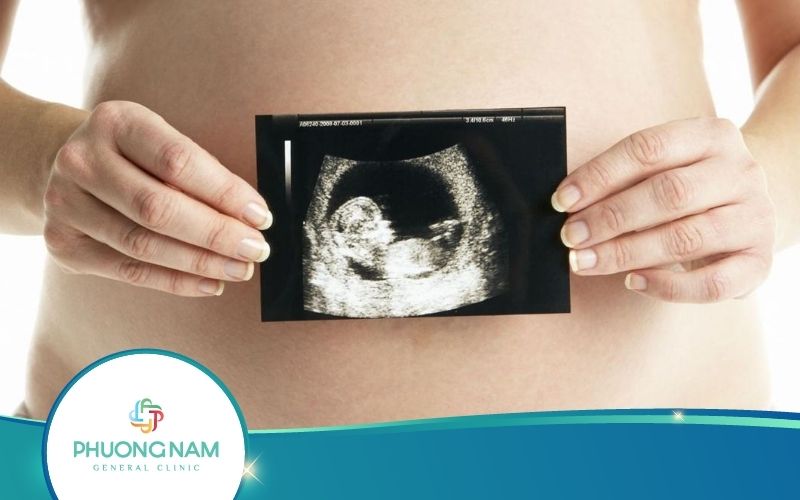 Siêu Âm 20 Tuần Giúp Mẹ Bầu Biết Được Gì? – Chia Sẻ Từ Chuyên Gia