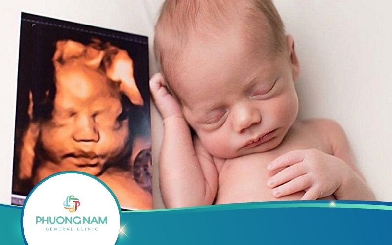 Siêu Âm 3D – Những Điều Các Mẹ Bầu Cần Nắm Rõ