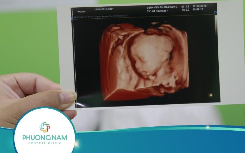 Siêu Âm Thai 4D – Kỹ Thuật Chẩn Đoán Thai Kỳ An Toàn, Chính Xác Cao