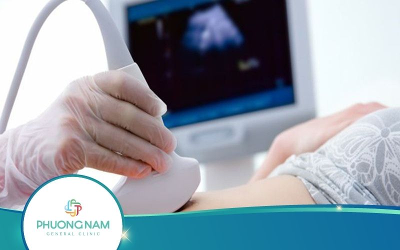 Siêu Âm Y Khoa Là Gì? Những Điều Cần Biết