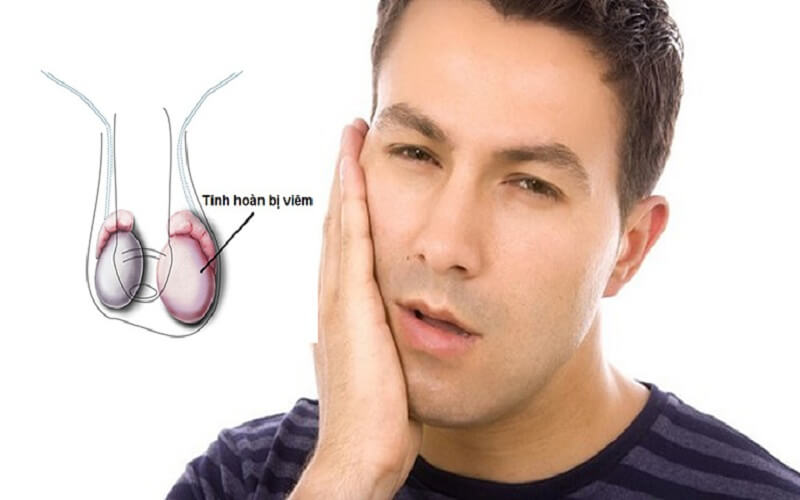 Những Sự Thật Bạn Nên Biết Về Bệnh Viêm Tinh Hoàn