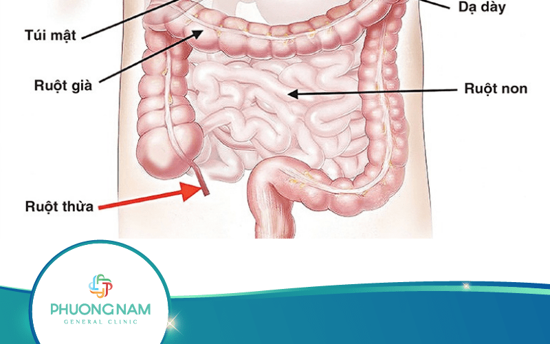 Chụp Cắt Lớp (CT) Hay Siêu Âm Ruột Thừa Hiệu Quả Hơn?