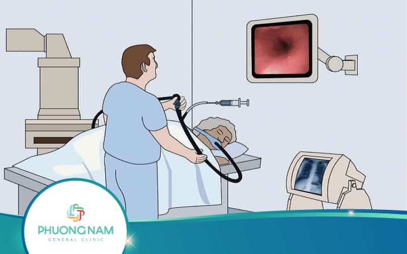 Siêu Âm Nội Soi Giúp Phát Hiện Các Bệnh Lý Nào?