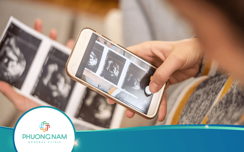 Các Mốc Siêu Âm Sản Khoa Quan Trọng Mẹ Nên Biết