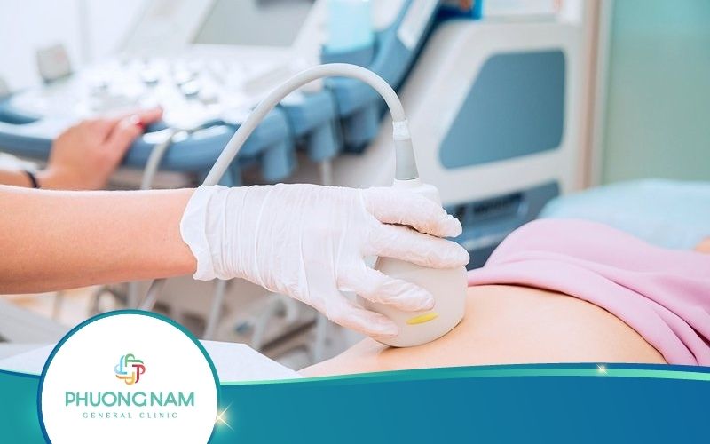Siêu Âm Bàng Quang – Những Điều Cần Biết