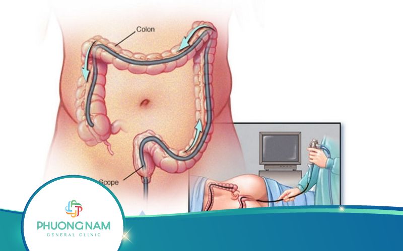Những Biểu Hiện Báo Hiệu Cơ Thể Cần Siêu Âm Qua Ngã Trực Tràng