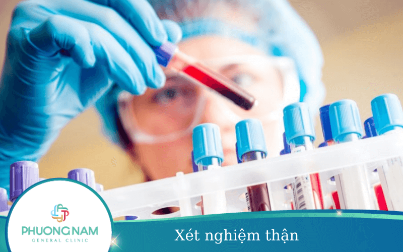 Xét Nghiệm Thận Cần Làm Những Gì? Ở Đâu Xét Nghiệm An Toàn?