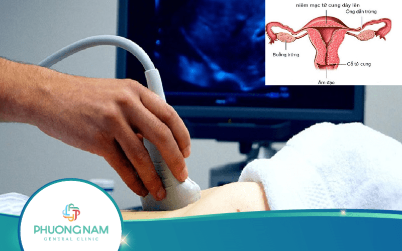 Siêu Âm Niêm Mạc Tử Cung Dày Hơn 20mm Có Sao Không?