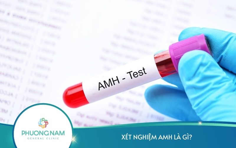 Xét Nghiệm Máu AMH Là Gì? – Ý Nghĩa Và Vai Trò