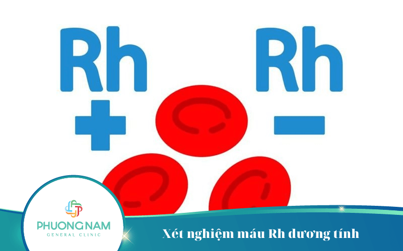 Thai Nhi Xét Nghiệm Máu Rh Dương Tính Cho Biết Điều Gì?