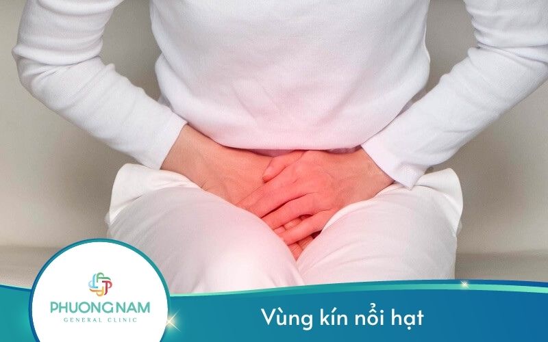 Vùng Kín Nổi Hạt – Dấu Hiệu Của Nhiều Bệnh Lý Nguy Hiểm