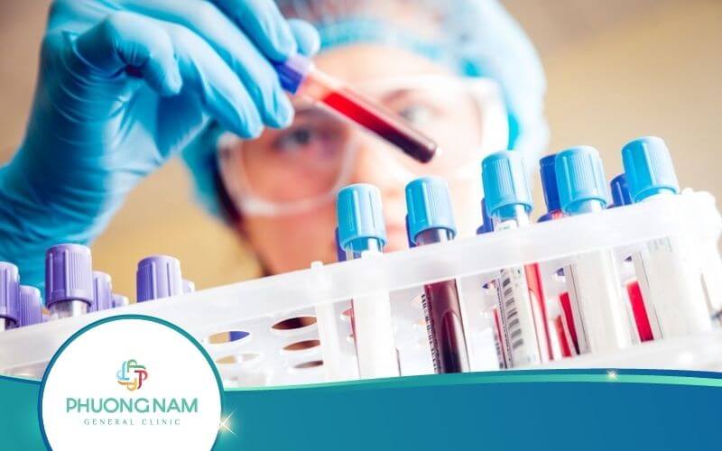 Xét Nghiệm ADN Bao Lâu Có Kết Quả? – Giải Đáp Chi Tiết