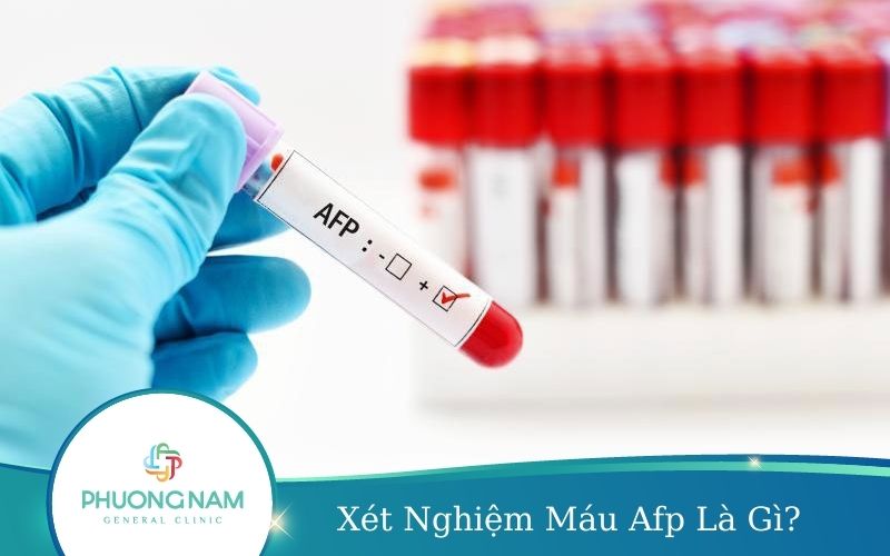 Xét Nghiệm Máu Afp Là Gì? Ý Nghĩa Của Xét Nghiệm Afp