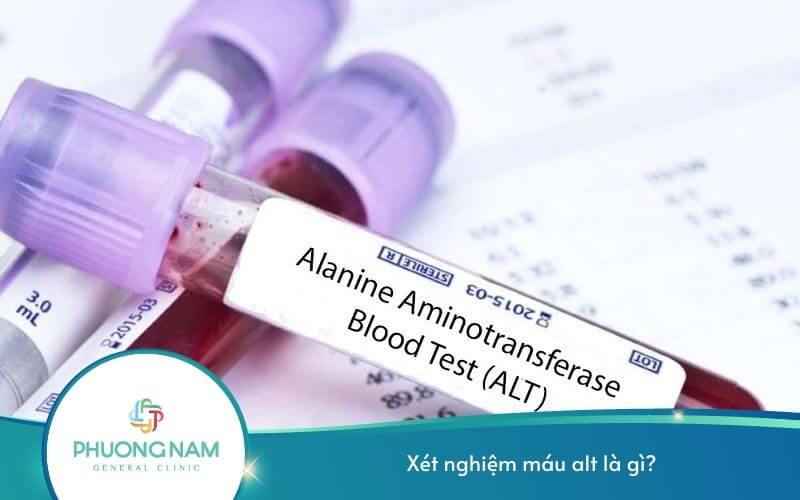 Xét Nghiệm Máu Alt Là Gì? – Ý Nghĩa Của Xét Nghiệm Alt