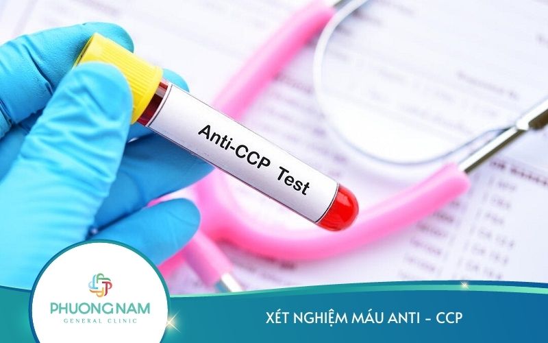 Xét Nghiệm Máu Anti Ccp – Hỗ Trợ Chẩn Đoán Viêm Khớp Dạng Thấp