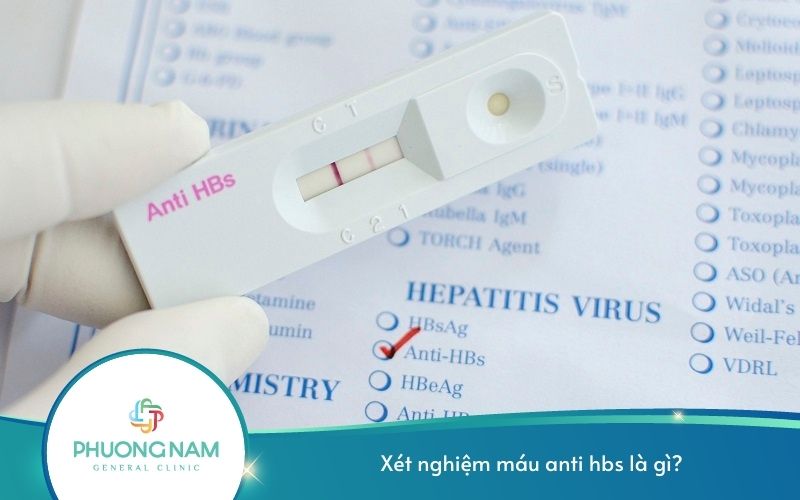 Xét Nghiệm Máu Anti Hbs Là Gì?