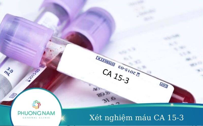 Xét Nghiệm Máu Ca 15-3- Đánh Giá Ung Thư Vú Hiệu Quả