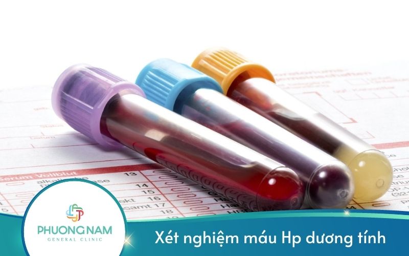 Xét Nghiệm Máu Hp Dương Tính Có Làm Sao Không?