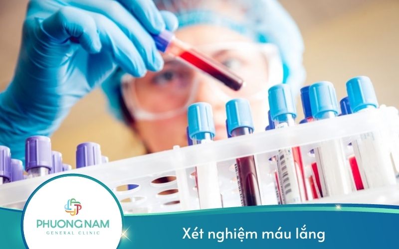 Xét Nghiệm Máu Lắng Để Làm Gì?