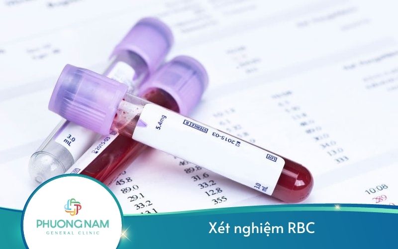 Xét Nghiệm Máu Rbc Là Gì? – Ý Nghĩa Và Những Vấn Đề Liên Quan