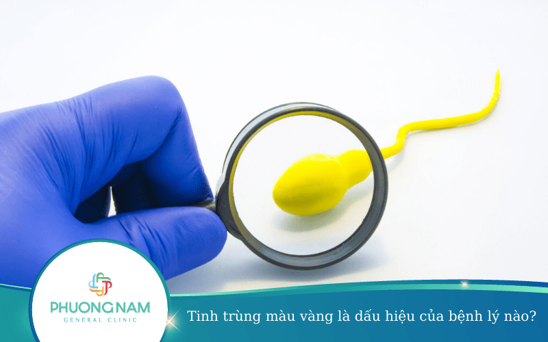 Tinh Trùng Màu Vàng Là Dấu Hiệu Của Bệnh Lý Nào?