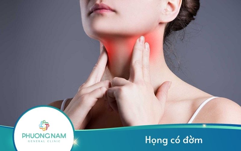 Họng Có Đờm – Nguyên Nhân và Cách Điều Trị